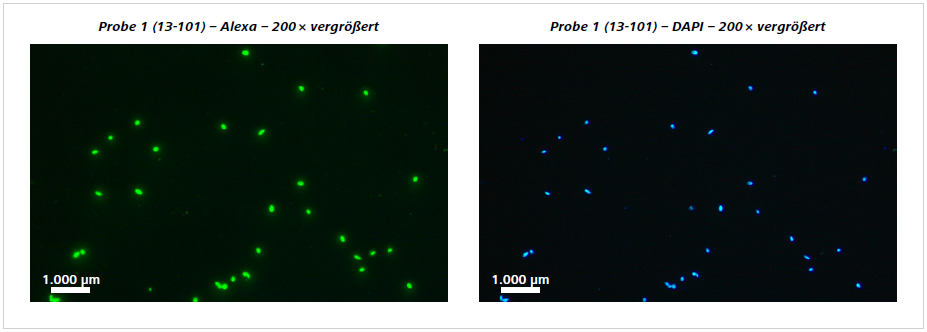 Abbildung 3 Einzelproben: Antikörper basierte Spermienfärbung mit HY-Liter (grüne Fluoreszenz) und parallele Anfärbung der Zellkerne mit DAPI